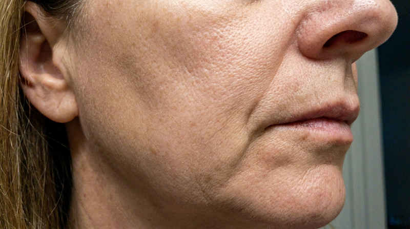 Woman looking in mirror — perimenopause skin